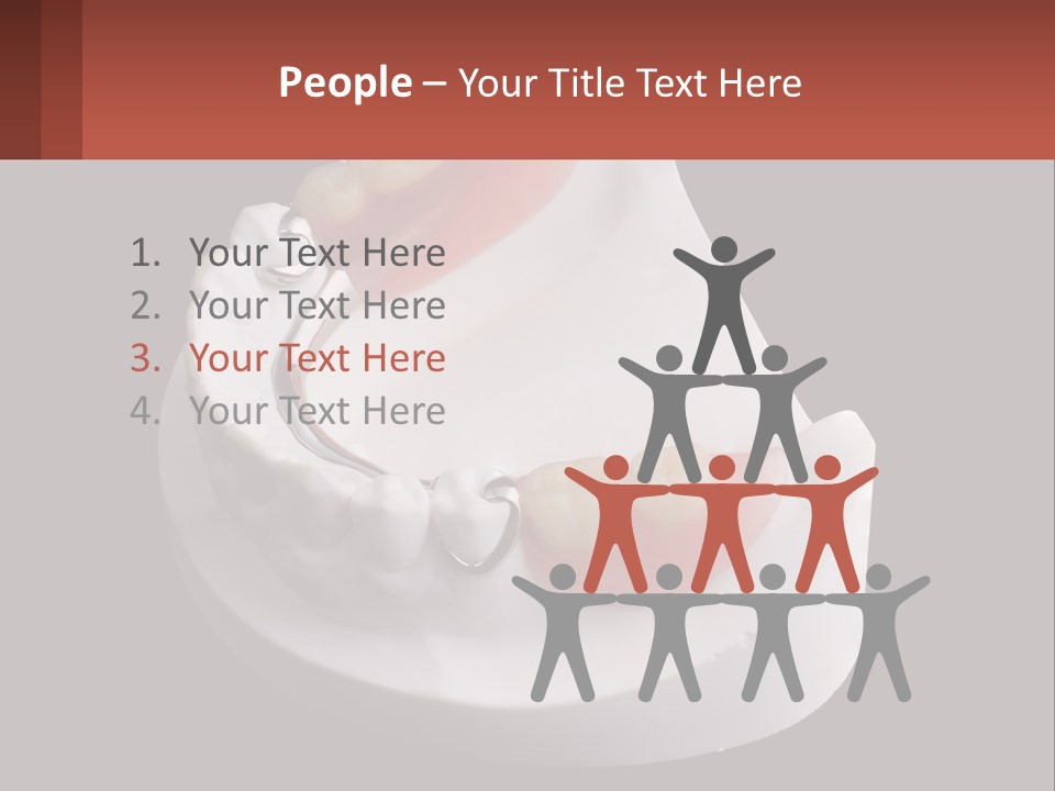 A Dental Model Of A Tooth With A Missing Tooth PowerPoint Template