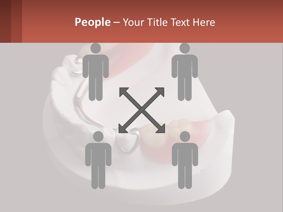 A Dental Model Of A Tooth With A Missing Tooth PowerPoint Template