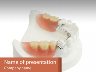A Dental Model Of A Tooth With A Brace On Top Of It PowerPoint Template