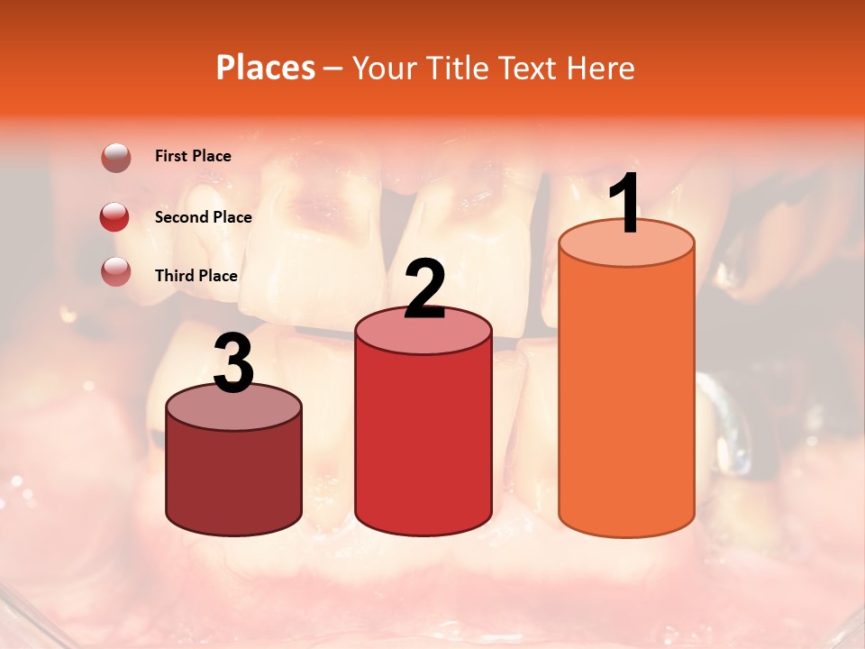 A Close Up Of A Person's Teeth With Gums PowerPoint Template