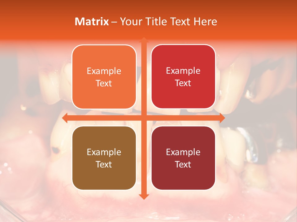 A Close Up Of A Person's Teeth With Gums PowerPoint Template