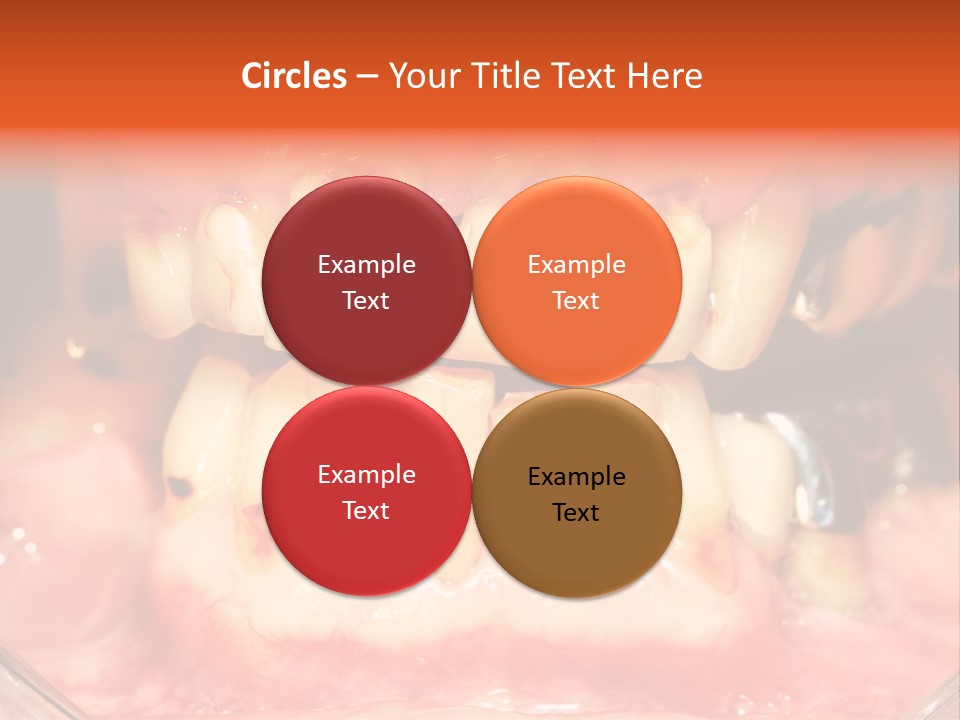 A Close Up Of A Person's Teeth With Gums PowerPoint Template