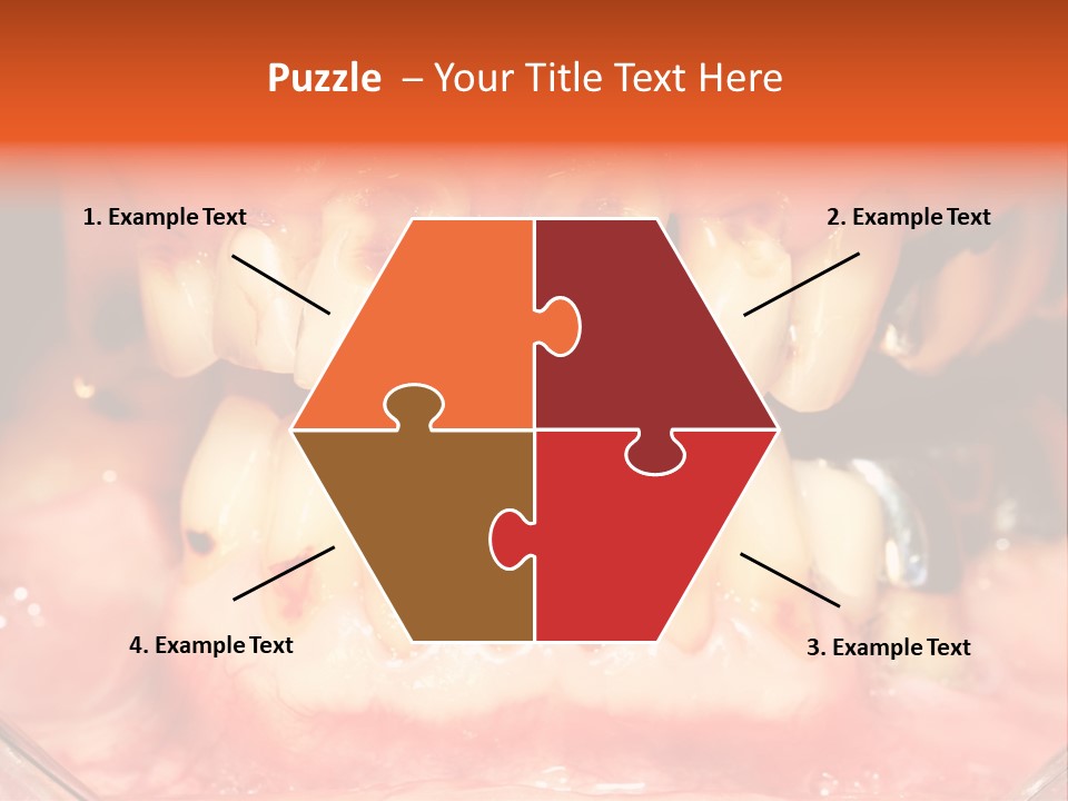 A Close Up Of A Person's Teeth With Gums PowerPoint Template