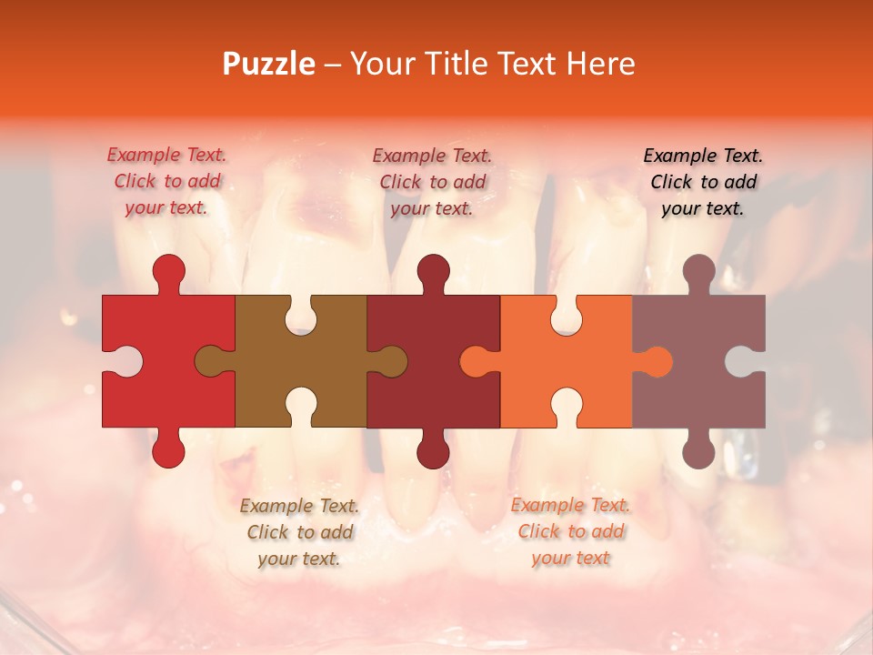 A Close Up Of A Person's Teeth With Gums PowerPoint Template