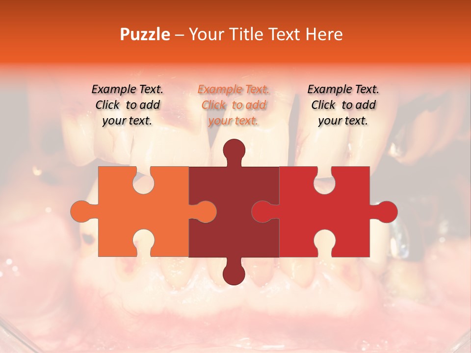 A Close Up Of A Person's Teeth With Gums PowerPoint Template