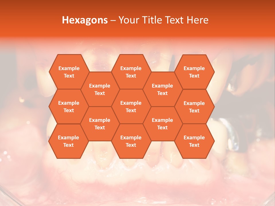 A Close Up Of A Person's Teeth With Gums PowerPoint Template