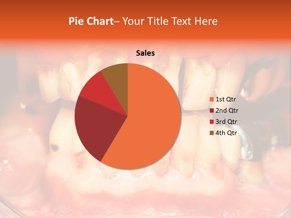 A Close Up Of A Person's Teeth With Gums PowerPoint Template