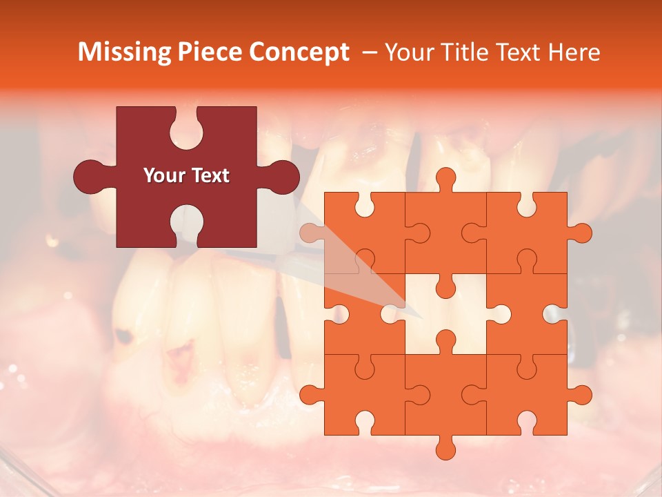A Close Up Of A Person's Teeth With Gums PowerPoint Template