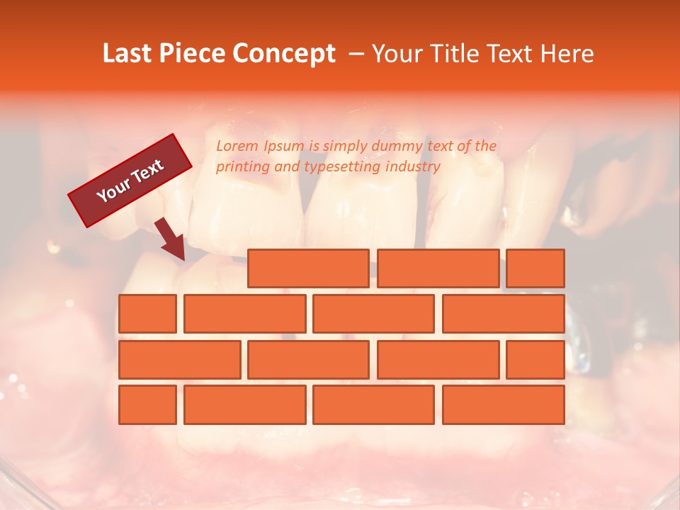 A Close Up Of A Person's Teeth With Gums PowerPoint Template