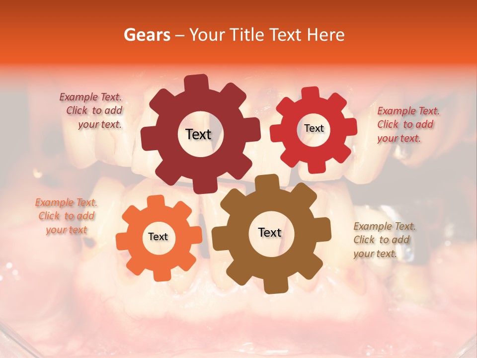 A Close Up Of A Person's Teeth With Gums PowerPoint Template