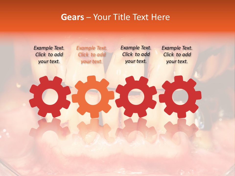 A Close Up Of A Person's Teeth With Gums PowerPoint Template