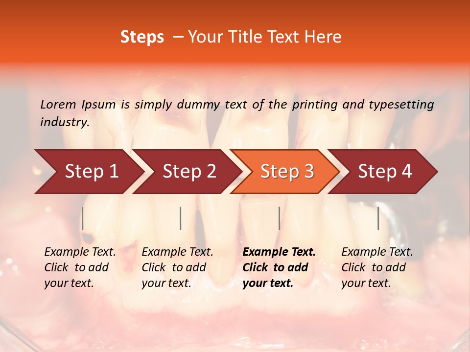A Close Up Of A Person's Teeth With Gums PowerPoint Template