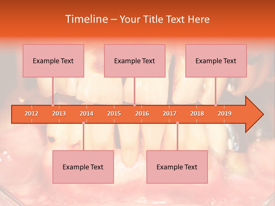 A Close Up Of A Person's Teeth With Gums PowerPoint Template