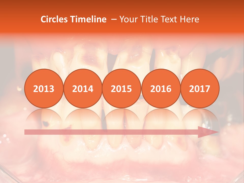 A Close Up Of A Person's Teeth With Gums PowerPoint Template