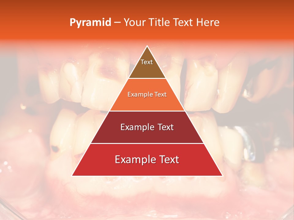 A Close Up Of A Person's Teeth With Gums PowerPoint Template