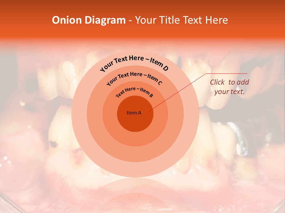 A Close Up Of A Person's Teeth With Gums PowerPoint Template