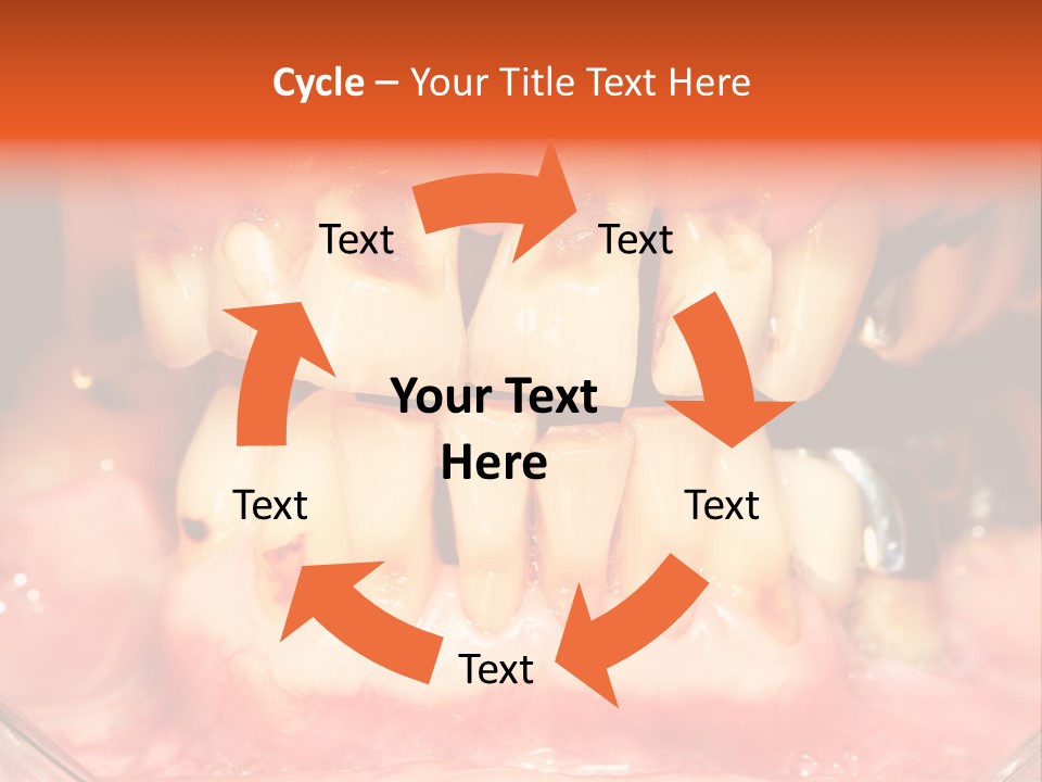 A Close Up Of A Person's Teeth With Gums PowerPoint Template