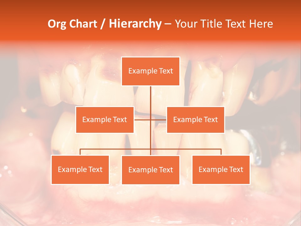 A Close Up Of A Person's Teeth With Gums PowerPoint Template