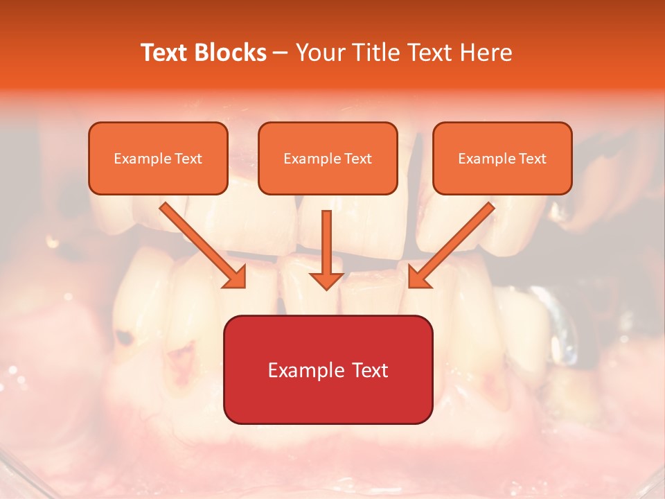 A Close Up Of A Person's Teeth With Gums PowerPoint Template