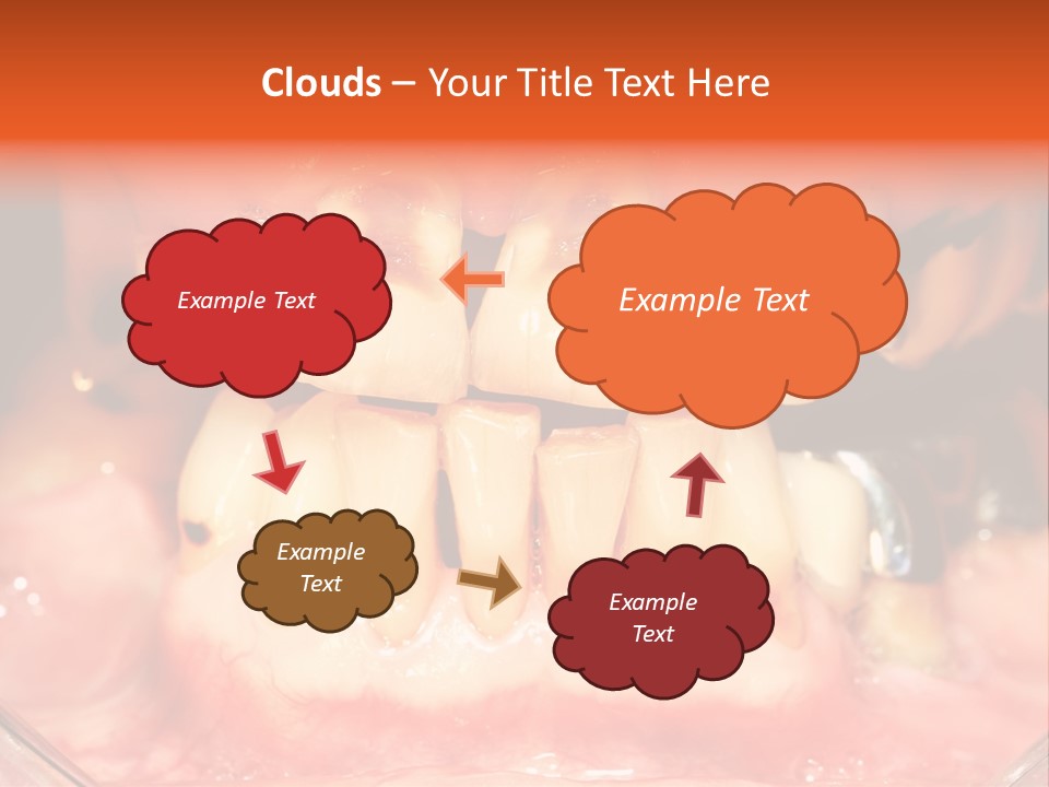 A Close Up Of A Person's Teeth With Gums PowerPoint Template