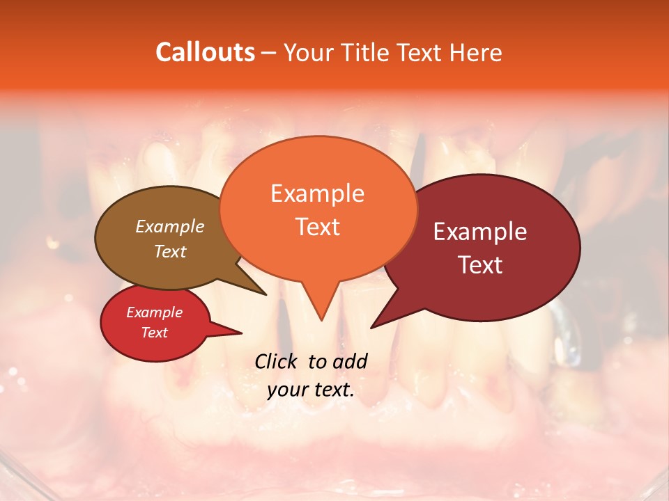 A Close Up Of A Person's Teeth With Gums PowerPoint Template