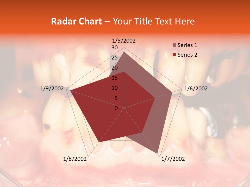 A Close Up Of A Person's Teeth With Gums PowerPoint Template
