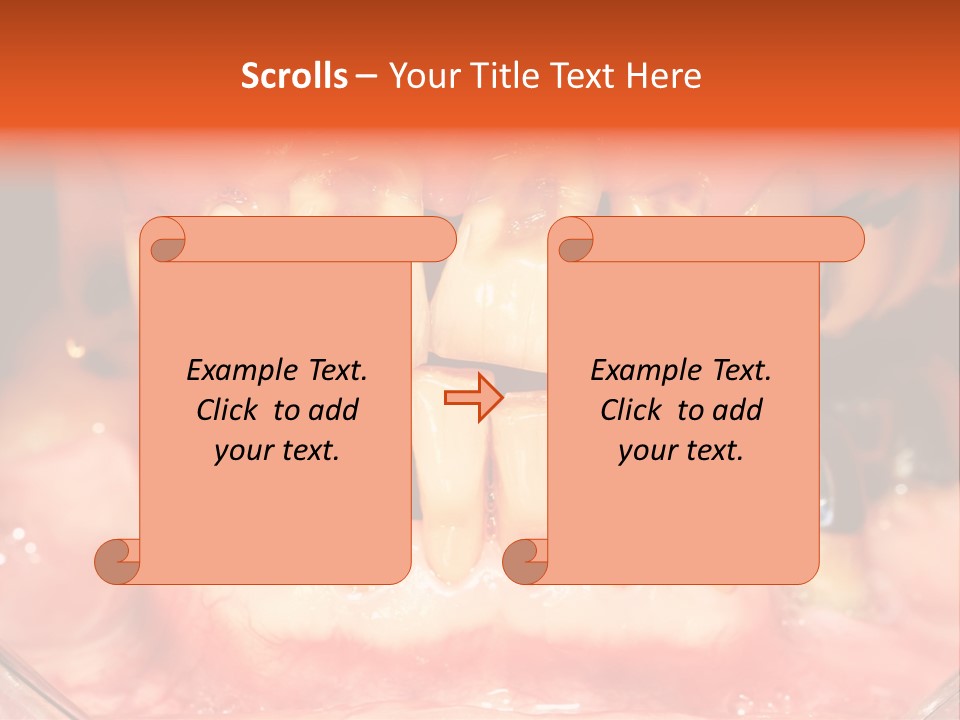 A Close Up Of A Person's Teeth With Gums PowerPoint Template