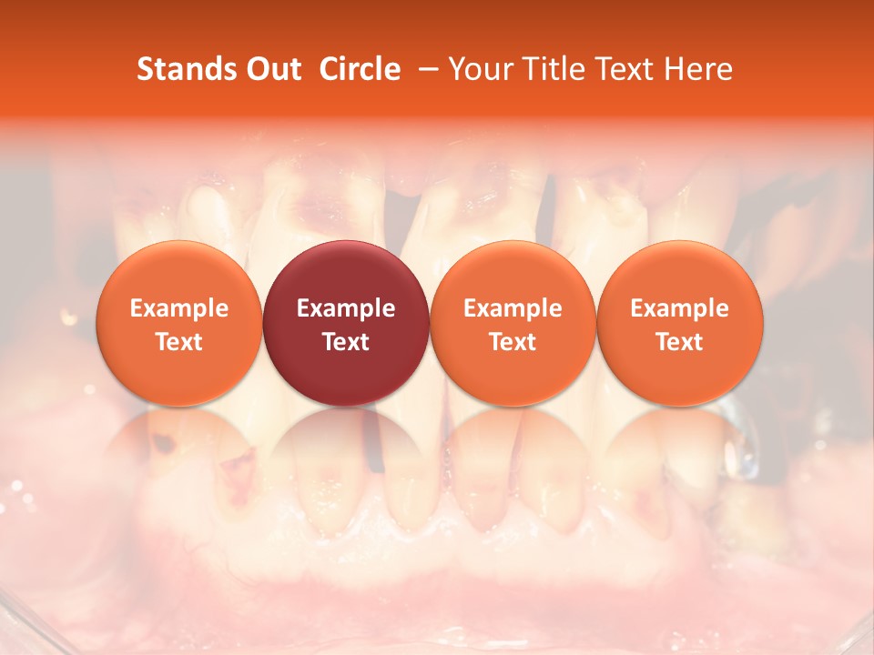 A Close Up Of A Person's Teeth With Gums PowerPoint Template
