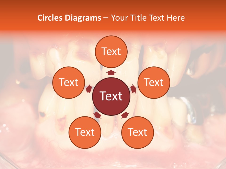 A Close Up Of A Person's Teeth With Gums PowerPoint Template