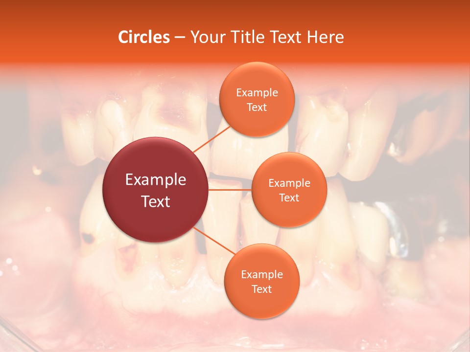 A Close Up Of A Person's Teeth With Gums PowerPoint Template