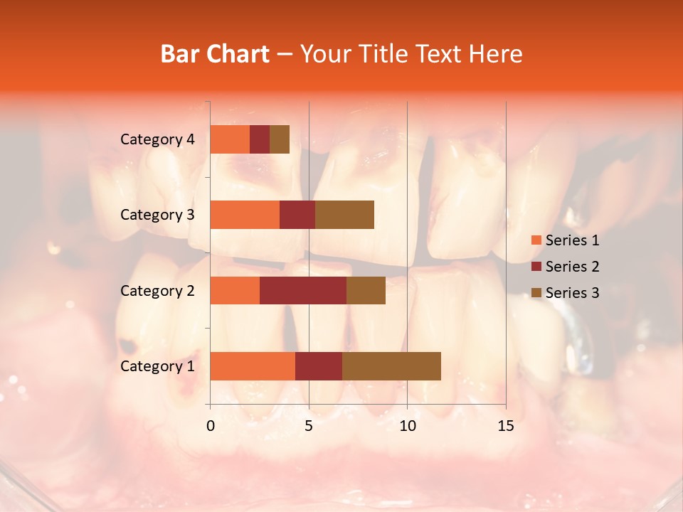 A Close Up Of A Person's Teeth With Gums PowerPoint Template