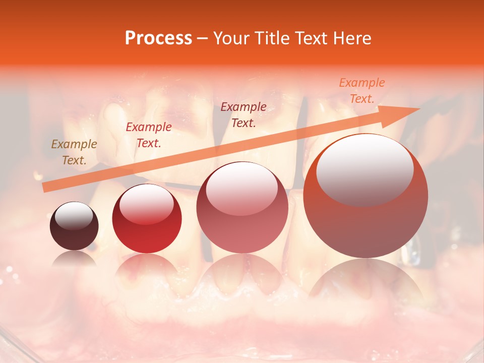 A Close Up Of A Person's Teeth With Gums PowerPoint Template