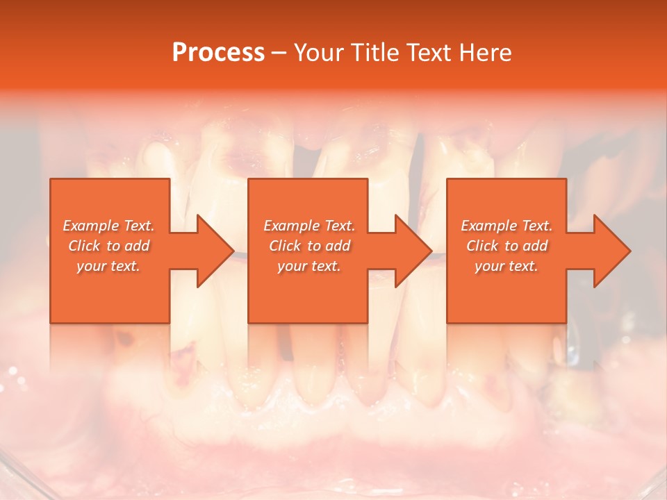 A Close Up Of A Person's Teeth With Gums PowerPoint Template