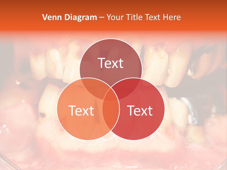 A Close Up Of A Person's Teeth With Gums PowerPoint Template