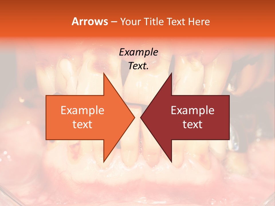 A Close Up Of A Person's Teeth With Gums PowerPoint Template