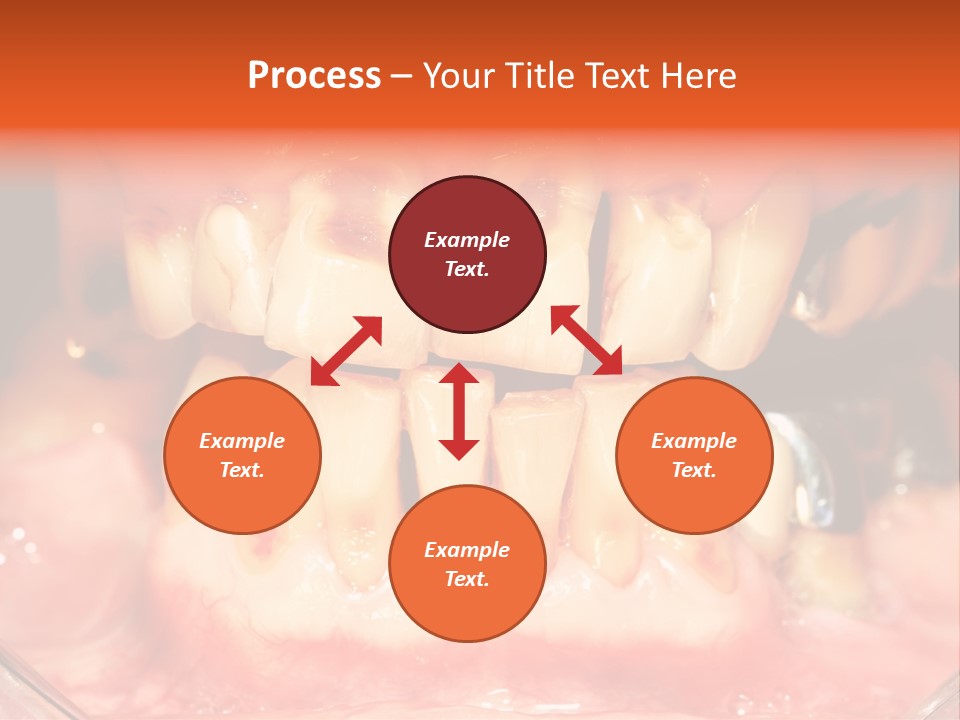 A Close Up Of A Person's Teeth With Gums PowerPoint Template