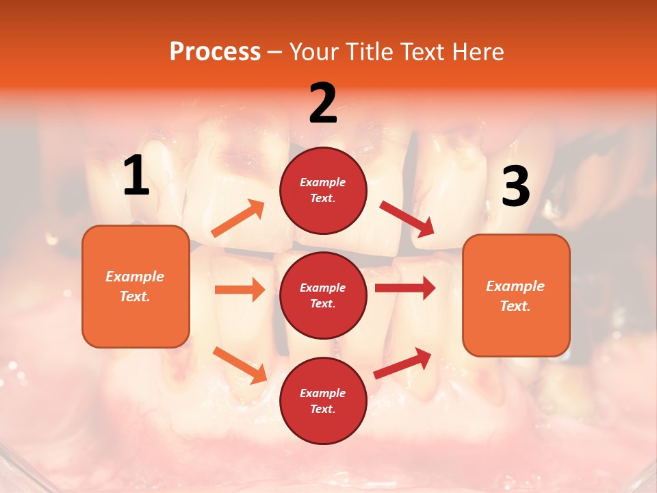 A Close Up Of A Person's Teeth With Gums PowerPoint Template