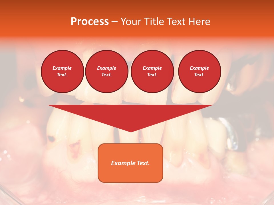 A Close Up Of A Person's Teeth With Gums PowerPoint Template