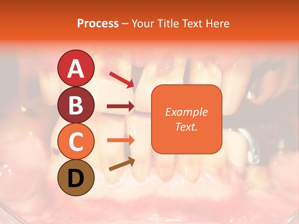 A Close Up Of A Person's Teeth With Gums PowerPoint Template