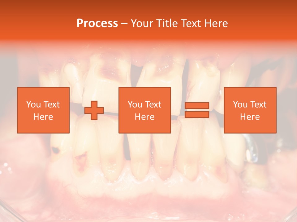 A Close Up Of A Person's Teeth With Gums PowerPoint Template