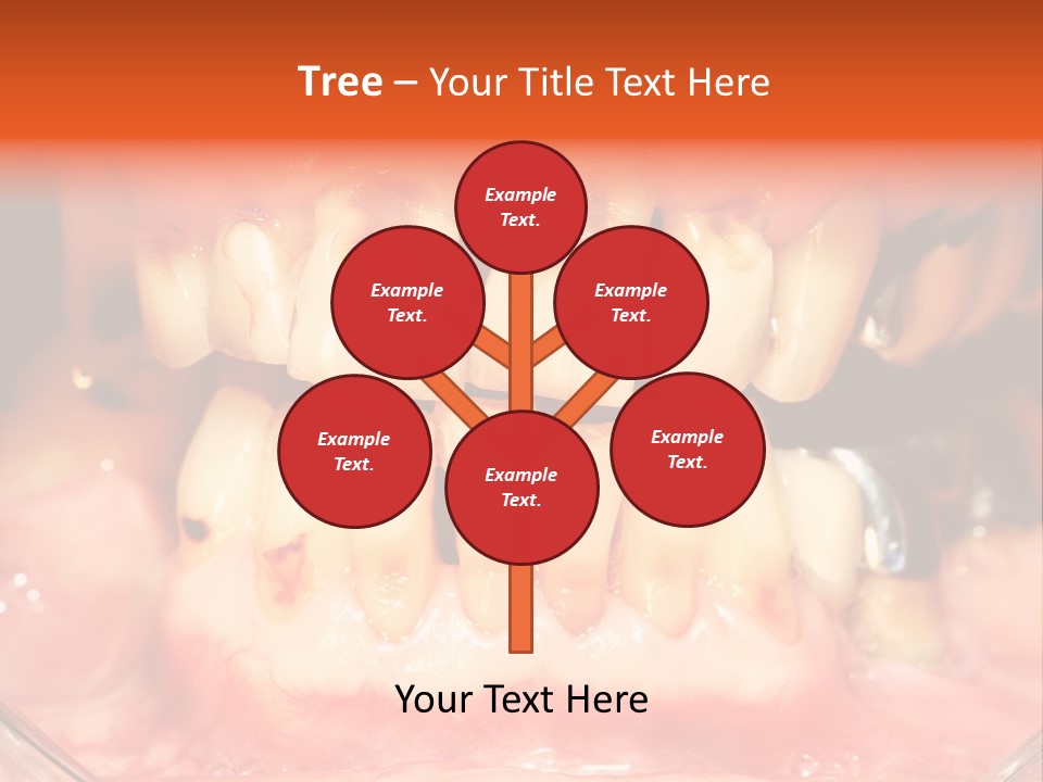 A Close Up Of A Person's Teeth With Gums PowerPoint Template