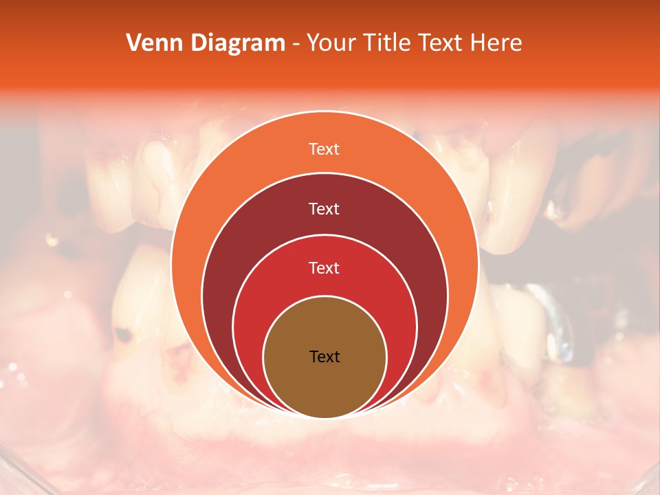 A Close Up Of A Person's Teeth With Gums PowerPoint Template