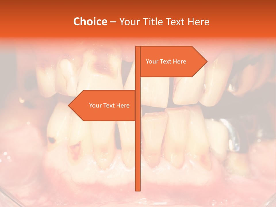 A Close Up Of A Person's Teeth With Gums PowerPoint Template