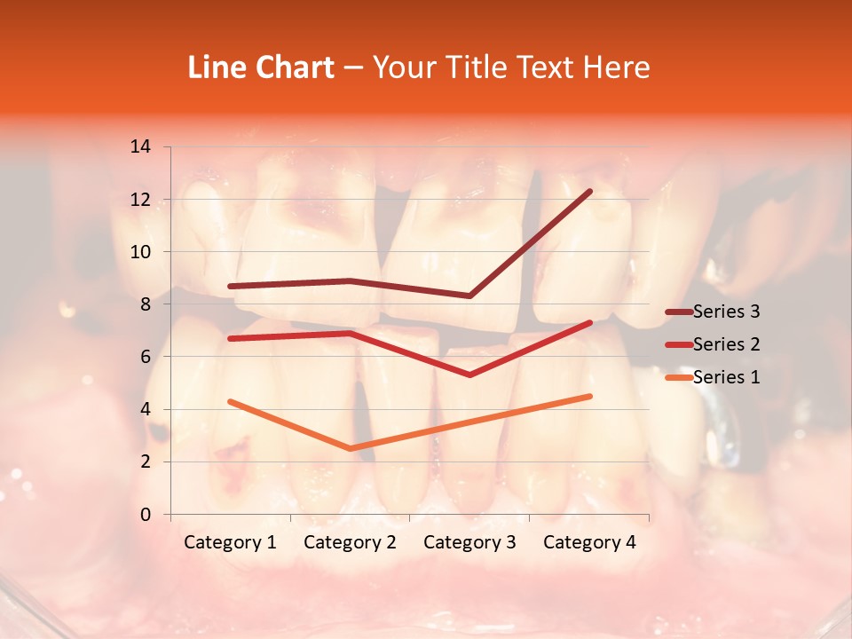 A Close Up Of A Person's Teeth With Gums PowerPoint Template