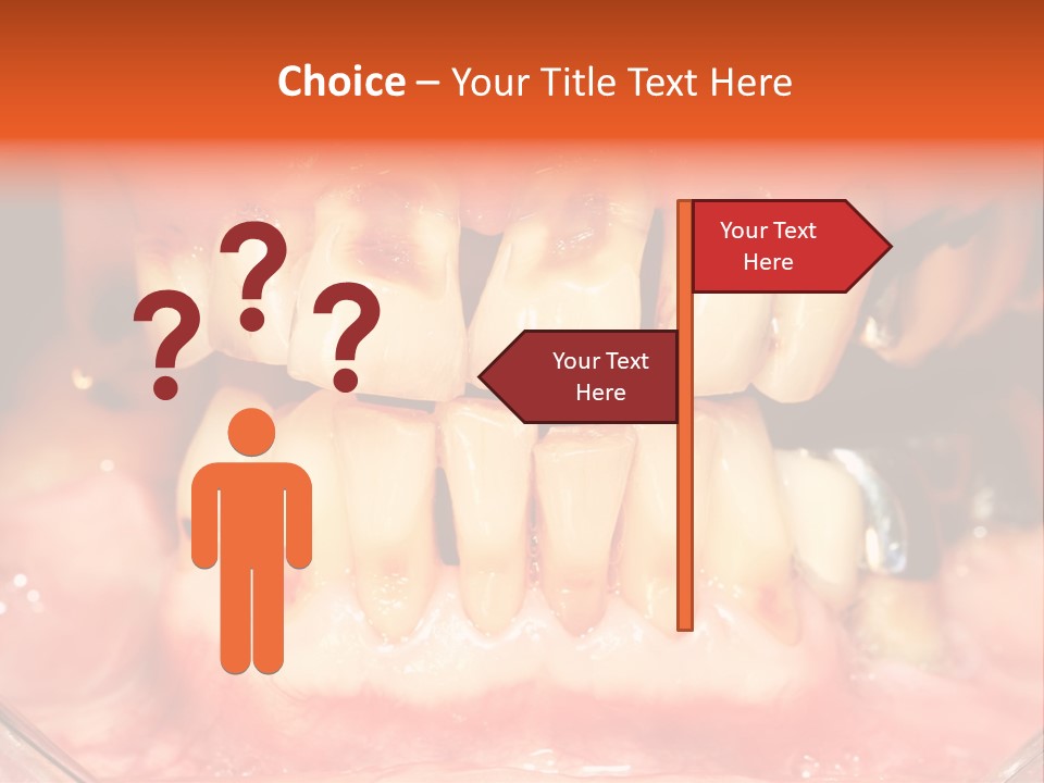 A Close Up Of A Person's Teeth With Gums PowerPoint Template