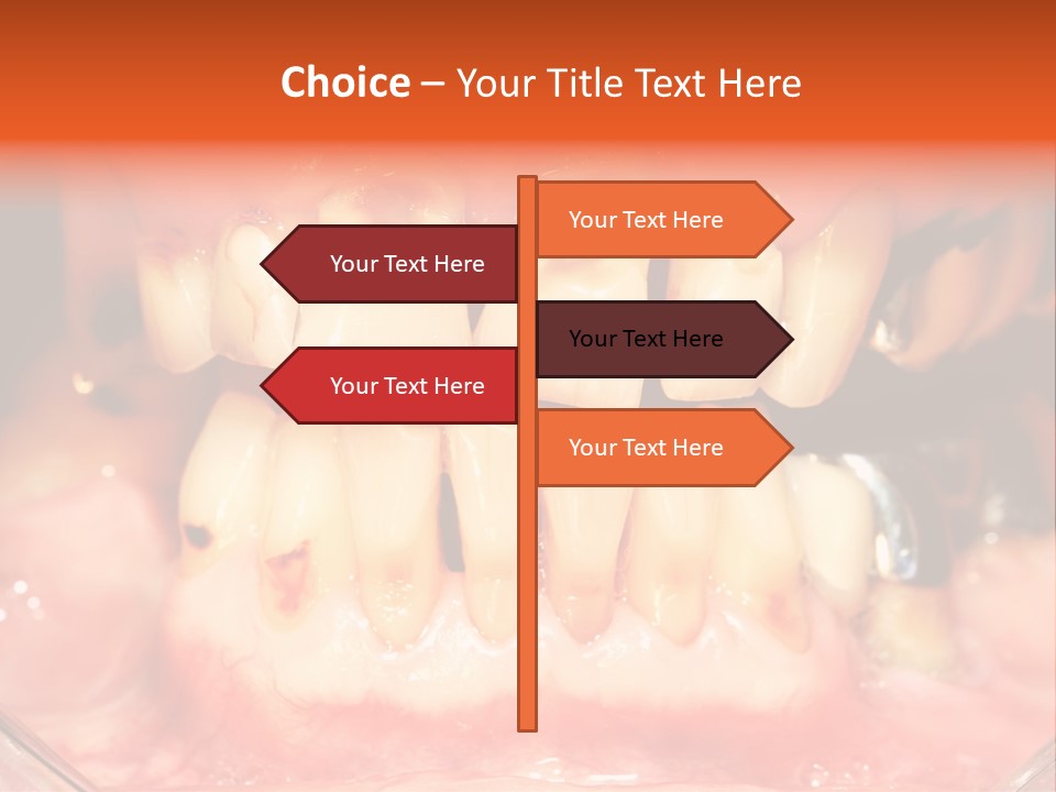 A Close Up Of A Person's Teeth With Gums PowerPoint Template