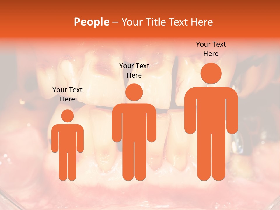 A Close Up Of A Person's Teeth With Gums PowerPoint Template