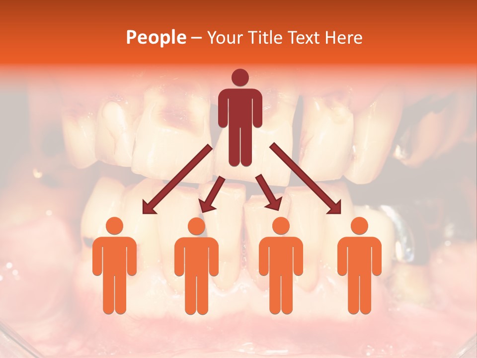 A Close Up Of A Person's Teeth With Gums PowerPoint Template