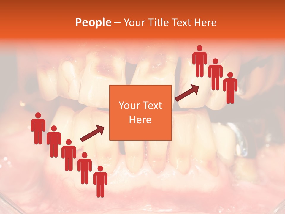 A Close Up Of A Person's Teeth With Gums PowerPoint Template