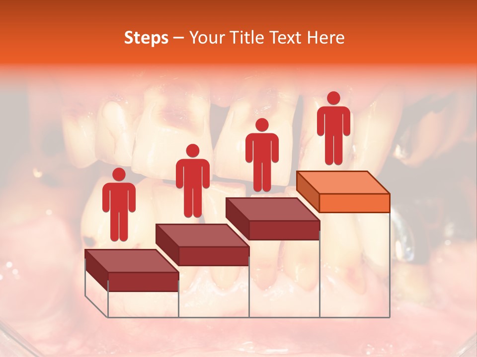 A Close Up Of A Person's Teeth With Gums PowerPoint Template